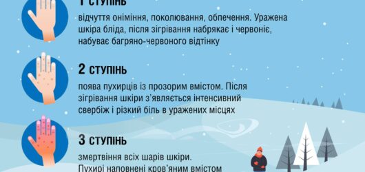 Важливо! Як розпізнати обмороження?