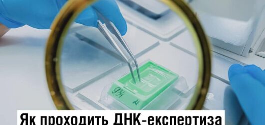 Як проходить ДНК-експертиза для пошуку загиблих та зниклих безвісти?