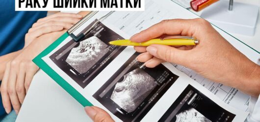 Безоплатна діагностика для раннього виявлення раку шийки матки