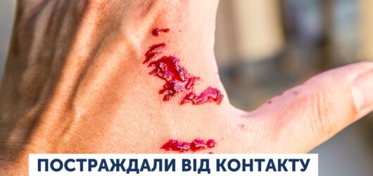 Постаждали від контакту з твариною: куди звертатись та як діяти?