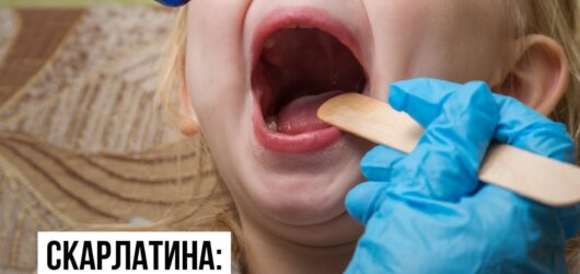 Скарлатина