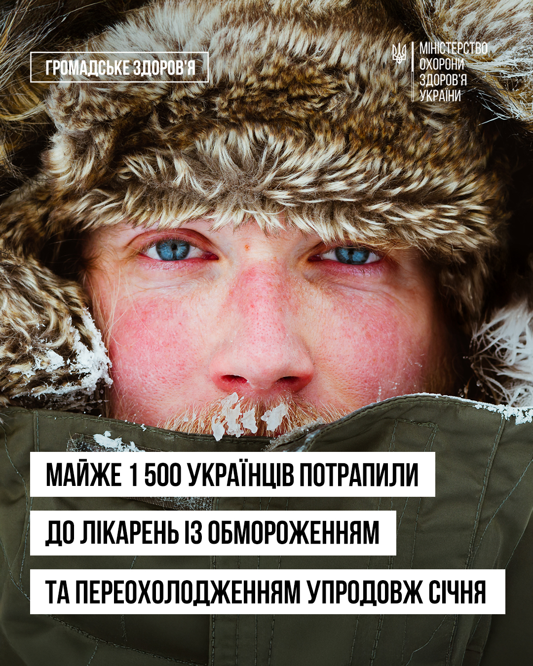 You are currently viewing Морози без наслідків: як захиститися від холодової травми