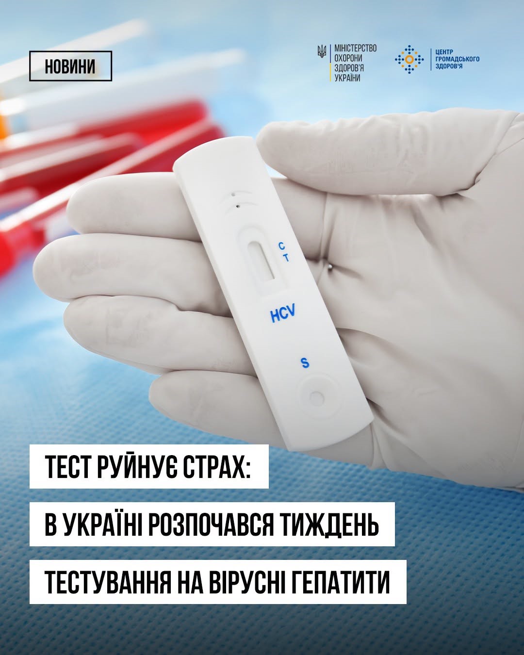 You are currently viewing Безоплатний тест на гепатити В і С: скористайтеся можливістю