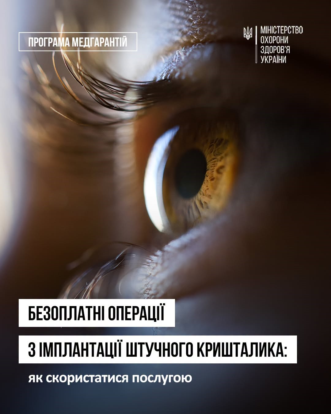 Read more about the article Понад 25 тисяч пацієнтів отримали безоплатне лікування катаракти